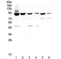 Western blot testing of human 1) HeLa, 2) PC-3, 3) Caco-2, 4) A549, 5) K562 and 6) Raji cell lysate with STAT1 antibody at 0.5ug/ml. Predicted molecular weight ~91/84 kDa (alpha/beta).