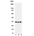 Western blot testing of Cd134 antibody and mouse samples 1: brain; 2: spleen; 3: liver tissue lysate. Expected molecular weight: 29-50 kDa depending on glcyosylation level.