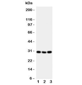 Western blot testing of Cd134 antibody and mouse samples 1: brain; 2: spleen; 3: liver tissue lysate. Expected molecular weight: 29-50 kDa depending on glcyosylation level.