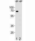 Western blot analysis of ETV5 antibody pre-incubated without (Lane 1) and with (2) blocking peptide in SW480 lysate