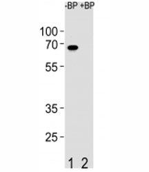 Western blot analysis of ETV5 antibody pre-incubated without (Lane 1) and with (2) blocking peptide in SW480 lysate