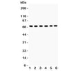 Western blot testing of PKC iota antibody and Lane 1: SHG-44; 2: A549; 3: U87; 4: 293T; 5: HeLa; 6: Jurkat. Predicted/expected size ~68KD