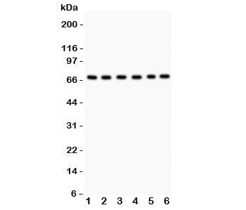 Western blot testing of PKC iota antibody and Lane 1: SHG-44; 2: A549; 3: U87; 4: 293T; 5: HeLa; 6: Jurkat. Predicted/expected size ~68KD
