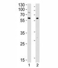 Western blot analysis of lysate from 1) Raji and 2) Ramos cell lines using LYN antibody at 1:1000. Predicted molecular weight ~53 kDa (p53lyn), ~56 kDa (p56lyn).