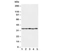 Western blot testing of CDK1 antibody and Lane 1: HeLa; 2: 293T; 3: A431; 4: CEM; 5: Jurkat cell lysate. Predicted molecular weight: ~33 kDa.