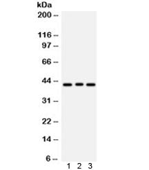 Western blot testing of 1) rat brain, 2) human COLO320 and 3) human HeLa lysate with ATXN3 antibody. Predicted/observed molecular weight ~42 kDa.