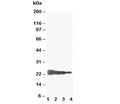 Western blot testing of Growth Hormone antibody and Lane 1: Recombinant human GH protein 10ng; 2: 5ng; 3: 2.5ng; 4: 1.25ng