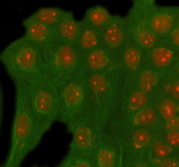 Immunofluorescent staining of RAD54L2 using anti-RAD54L2 antibody (red) and anti-Beta Tubulin antibody (green). RAD54L2 was detected in immunocytochemical section of cell. Enzyme antigen retrieval was performed using IHC enzyme antigen retrieval reagent for 15 mins. The cells were blocked with 10% goat serum. And then incubated with 5 ug/ml rabbit anti-RAD54L2 antibody and mouse anti-Beta Tubulin antibody overnight at 4oC.