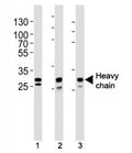 Western blot analysis of lysate from (1) A431, (2) MCF-7, (3) SK-BR-3 cell line using Cathepsin D antibody at 1:1000. Expected molecular weight: 43-46 kDa, 28 kDa (heavy chain), 15 kDa (light chain).