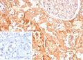 IHC staining of FFPE human kidney tissue with CASP7 antibody (clone CASP7/9053). Inset: PBS used in place of primary Ab (secondary Ab negative control). HIER: boil tissue sections in pH 9 10mM Tris with 1mM EDTA for 20 min and allow to cool before testing.