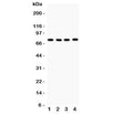 Western blot testing of PKC alpha antibody and Lane 1: rat brain; 2: mouse brain; 3: (m) heart; 4: human 22RV1. Predicted molecular weight: ~77 kDa.