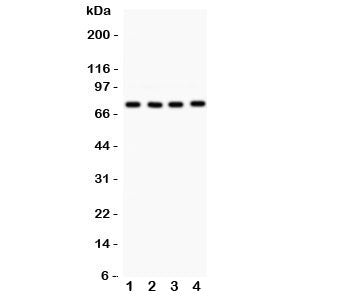 Western blot testing of PKC alpha antibody and Lane 1: rat brain; 2: mouse brain; 3: (m) heart; 4: human 22RV1. Predicted molecular weight: ~77 kDa.