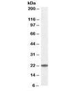 Western blot testing of human K562 cell lysate with UBE2T antibody at 0.1ug/ml. Predicted/observed molecular weight: ~22 kDa.