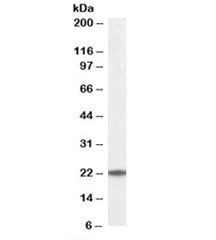 Western blot testing of human K562 cell lysate with UBE2T antibody at 0.1ug/ml. Predicted/observed molecular weight: ~22 kDa.