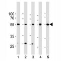 Western blot analysis of lysate from 1) HeLa, 2) K562, 3) MCF-7 cell line, 4) human liver and 5) mouse liver tissue lysate using BMPR1A antibody at 1:1000. Predicted molecular weight ~60 kDa.