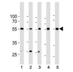 Western blot analysis of lysate from 1) HeLa, 2) K562, 3) MCF-7 cell line, 4) human liver and 5) mouse liver tissue lysate using BMPR1A antibody at 1:1000. Predicted molecular weight ~60 kDa.