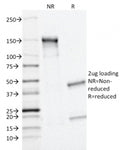 SDS-PAGE analysis of purified, BSA-free MRP1 antibody (clone MRP1/1343) as confirmation of integrity and purity.