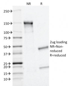 SDS-PAGE analysis of purified, BSA-free MRP1 antibody (clone MRP1/1343) as confirmation of integrity and purity.