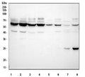 Western blot testing of human recombinant protein with TIM1 antibody. Predicted molecular weight~39 kDa, routinely observed at ~55 kDa (Ref 1), and a heavily glycosylated mature form at ~100 kDa (Ref 2).