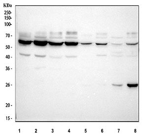 Western blot testing of human recombinant protein with TIM1 antibody. Predicted molecular weight~39 kDa, routinely observed at ~55 kDa (Ref 1), and a heavily glycosylated mature form at ~100 kDa (Ref 2).