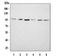 Western blot testing of human 1) U-87 MG, 2) PC-3, 3) 293T, 4) Jurkat, 5) HepG2 and 6) HeLa cell lysate with CD107b antibody. The protein can be extensively glycosylated and visualized from 45~110 kDa.