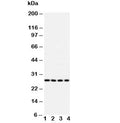 Western blot testing of Bcl10 antibody and Lane 1: U87; 2: MCF-7; 3: HeLa; 4: COLO320 cell lysate. Observed molecular weight: 26~33 kDa.