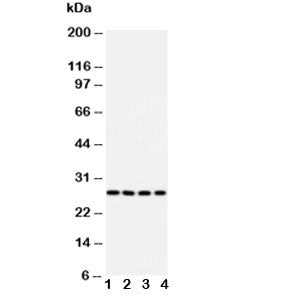 Western blot testing of Bcl10 antibody and Lane 1: U87; 2: MCF-7; 3: HeLa; 4: COLO320 cell lysate. Observed molecular weight: 26~33 kDa.