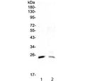 Western blot testing of 1) rat testis and 2) mouse testis lysate with StAR antibody at 0.5ug/ml. Expected molecular weight ~37 kDa (preprotein), ~30 kDa (mature form).
