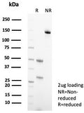 SDS-PAGE analysis of purified, BSA-free Keratin 10 antibody (clone KRT10/3861) as confirmation of integrity and purity.