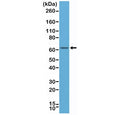 Western blot of human MCF-7 cell lysates using recombinant Estrogen Receptor alpha antibody at a 1:500 dilution. Predicted molecular weight ~66 kDa.