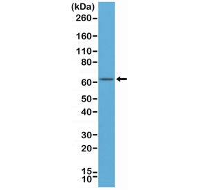 Western blot of human MCF-7 cell lysates using recombinant Estrogen Receptor alpha antibody at a 1:500 dilution. Predicted molecular weight ~66 kDa.