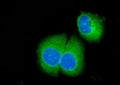 Immunofluorescent staining of FFPE human SiHa cells with Caspase-3 antibody (green) and DAPI nuclear stain (blue). HIER: steam section in pH6 citrate buffer for 20 min.