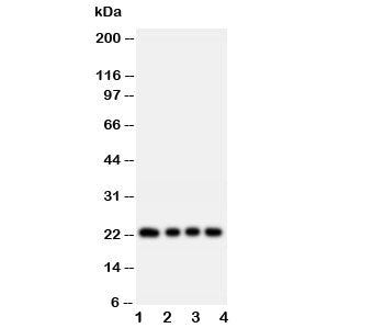 Western blot testing of FGF22 antibody and rat samples: 1. ovary; 2. ovary; 3. testis; 4. testis tissue lysate