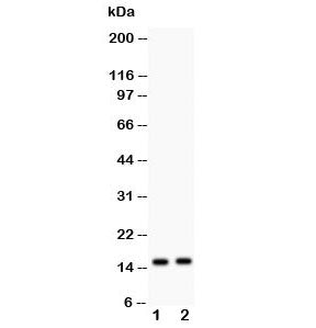 Western blot testing of FABP5 antibody and Lane 1) human HeLa and 2) HEPG2 lysate; Predicted molecular weight ~15 kDa.