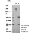 SDS-PAGE analysis of purified, BSA-free recombinant CD36 antibody (clone rGPIIIb/9240) as confirmation of integrity and purity.