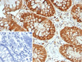 IHC staining of FFPE human colon tissue with Galectin 3 antibody (clone LGALS3/7145). Inset: PBS used in place of primary Ab (secondary Ab negative control). HIER: boil tissue sections in pH 9 10mM Tris with 1mM EDTA for 20 min and allow to cool before testing.
