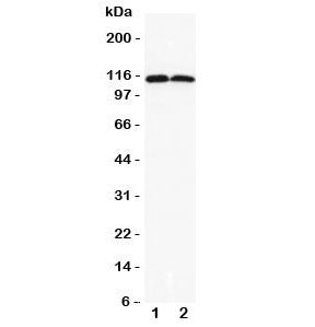 Western blot testing of DOG1 antibody and Lane 1) rat liver; 2) rat skeletal muscle lysate. Expected molecular weight 74-114 kDa but may be observed at higher molecular weights due to glycosylation.