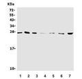 Western blot testing of 1) human HEK293, 2) human SW620, 3) human HeLa, 4) rat RH35, 5) mouse spleen, 6) mouse thymus and 7) mouse NIH 3T3 lysate with NTF4 antibody. Expected molecular weight: 22-45 depending on level of glycosylation.