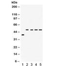Western blot testing of 1) rat intestine and human 2) SW620, 3) COLO320, 4) HeLa and 5) A549 lysate with IRF2 antibody. Estimated molecular weight: ~39 kDa but routinely observed at 39-50 kDa.