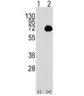 Western blot analysis of ACOX1 antibody and 293 cell lysate either nontransfected (Lane 1) or transiently transfected with the ACOX1 gene (2). Predicted molecular weight ~74 kDa.