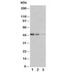 Western blot testing of ERBB3 antibody and Lane 1: Recombinant human protein 5ng; 2: 2.5ng; 3: 1.25ng