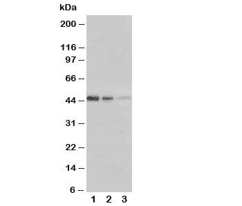 Western blot testing of ERBB3 antibody and Lane 1: Recombinant human protein 5ng; 2: 2.5ng; 3: 1.25ng