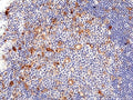 IHC staining of FFPE human tonsil tissue with recombinant IL2RA antibody at 1:200.
