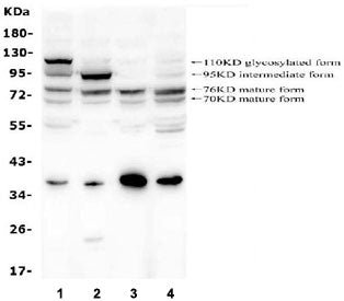 Western blot testing of human 1) A549, 2) HepG2, 3) HEK293 and 4) PC-3 cell lysate with GAA antibody at 0.5ug/ml. Expected molecular weight ~110 kDa (precursor), ~95 kDa (intermediate), ~76 and 70 kDa (lysosomal forms).