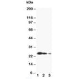 Western blot testing of TIMP3 antibody and Lane 1: recombinant human protein 10ng; 2: 5ng; 3: 2.5ng