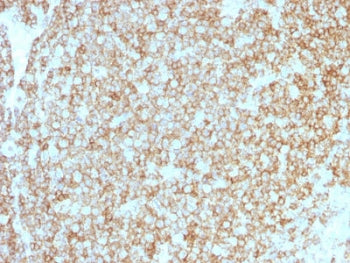 IHC testing of recombinant CD45 antibody cocktail and FFPE human tonsil (clones PTPRC/1975R + PTPRC/1783R). Required HIER: boil tissue sections in 10mM citrate buffer, pH 6, for 10-20 min followed by cooling at RT for 20 min.