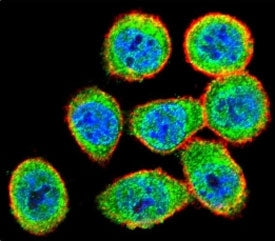 Confocal immunofluorescent analysis of IKK beta antibody with HeLa cells followed by Alexa Fluor 488-conjugated goat anti-rabbit lgG (green). Actin filaments have been labeled with Alexa Fluor 555 Phalloidin (red). DAPI was used as a nuclear counterstain (blue).