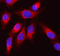 Immunofluorescent staining of SQRDL/SQOR using anti-SQOR antibody (red). SQRDL/SQOR was detected in an immunocytochemical section of PC-3 cells. Enzyme antigen retrieval was performed using IHC enzyme antigen retrieval reagent for 15 mins. The cells were blocked with 10% goat serum. And then incubated with 5 ug/ml rabbit anti-SQOR antibody overnight at 4oC. DyLight 550 Conjugated Goat Anti-Rabbit IgG was used as secondary antibody at 1:500 dilution and incubated for 30 min at 37oC.