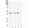Western blot testing of Asponrin antibody with lysate from 1) human tonsil (Ab at 1ug/ml), 2) human uterus (Ab at 0.3ug/ml), 3) mouse skeletal muscle (Ab at 0.3ug/ml), 4) rat skeletal muscle (Ab at 1ug/ml) and 5) human cerebellum (negative control, Ab at 1ug/ml). Predicted molecular weight ~40 kDa.
