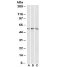 Western blot testing of human [A], mouse [B] and rat [C] heart lysates with ATP5B antibody at 0.3ug/ml. Predicted molecular weight: ~56kDa.